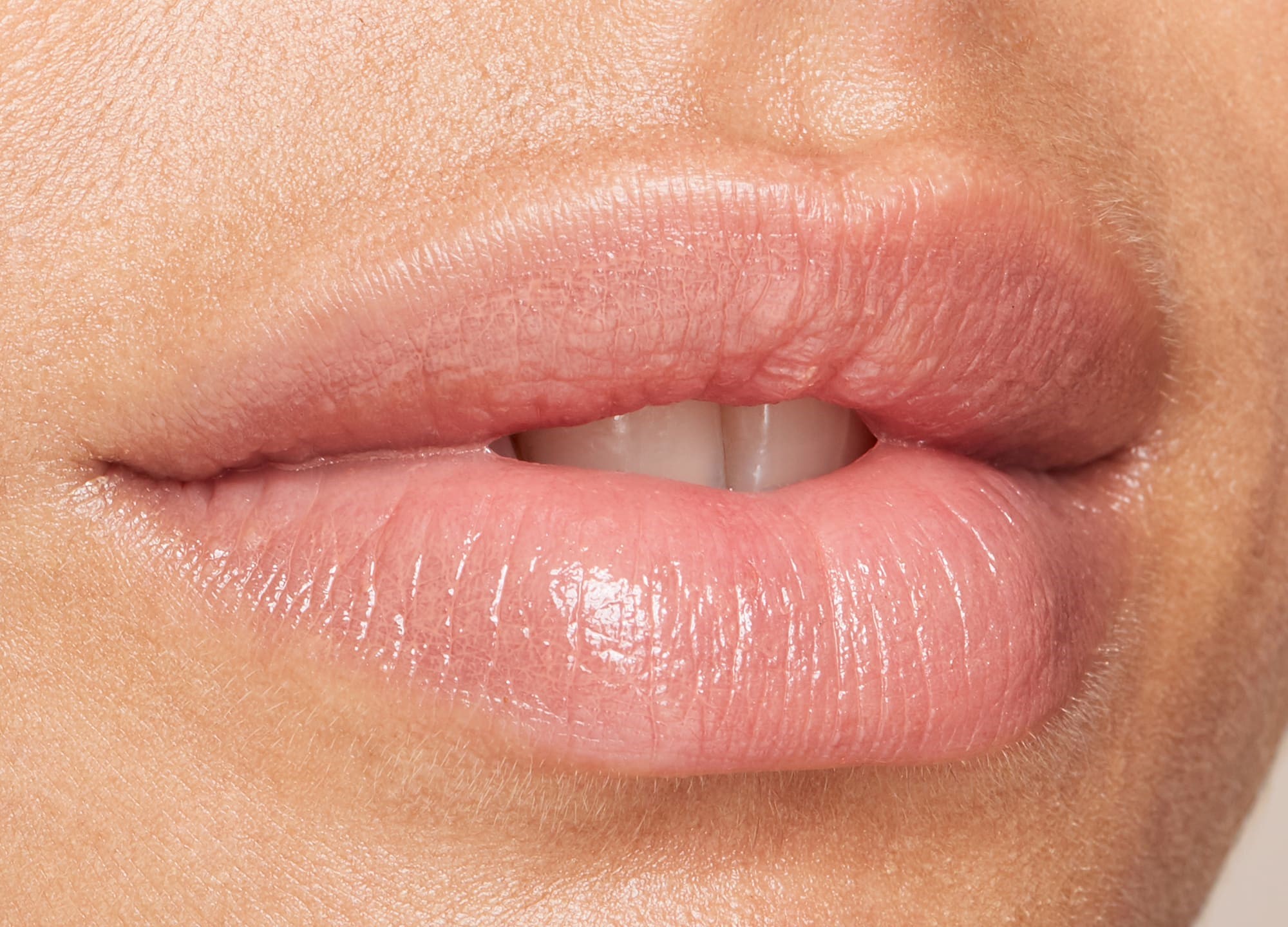 Cómo hacer que los resultados de su relleno de labios duren más